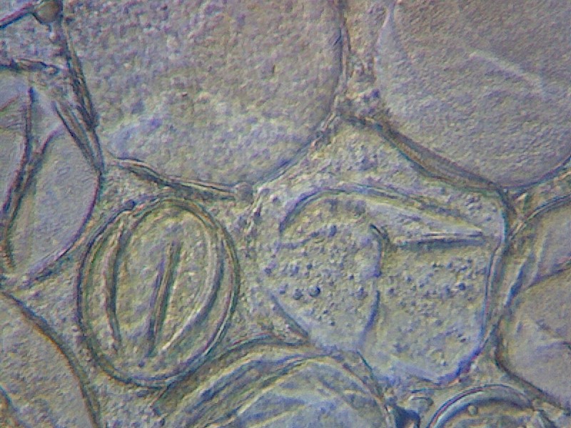 Pollen grains - photo by Thomas Bickerdike