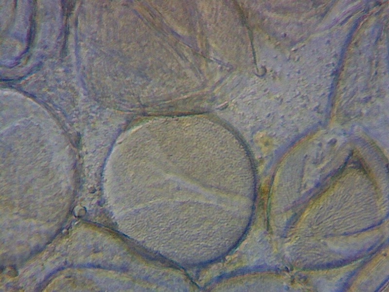 Pollen grains - photo by Thomas Bickerdike