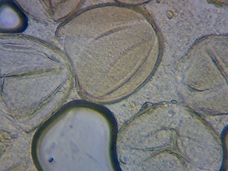 Pollen grains - photo by Thomas Bickerdike