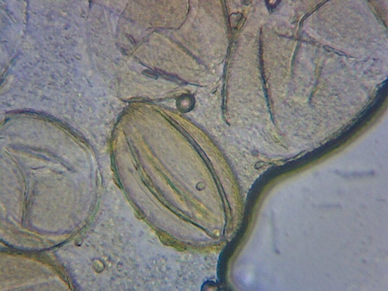 Pollen grains - photo by Thomas Bickerdike